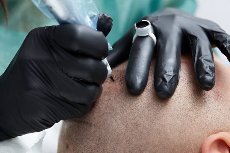 La Importancia de la Experiencia en la Micropigmentación Capilar