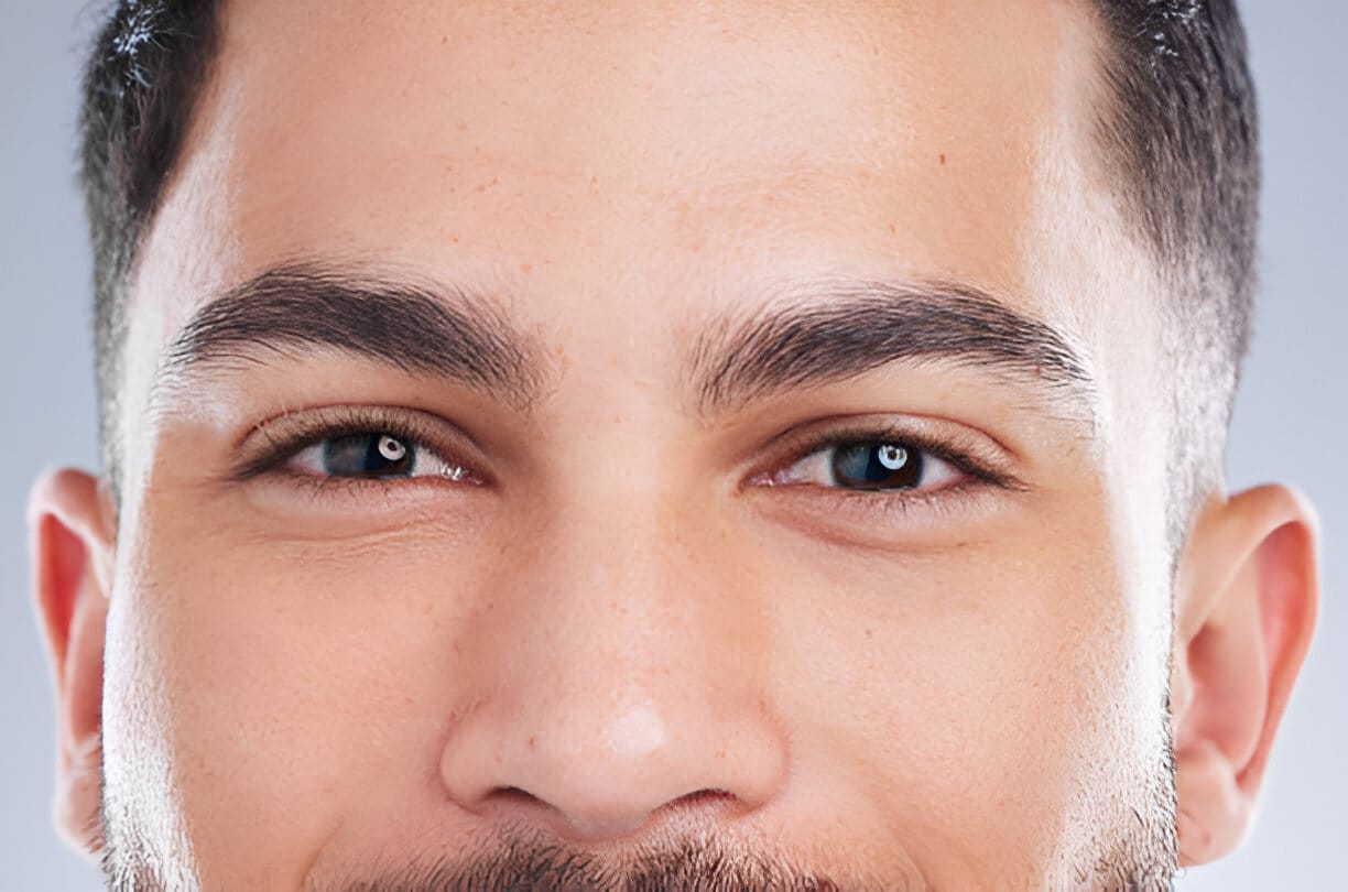 Trasplante Capilar de Cejas a Medida